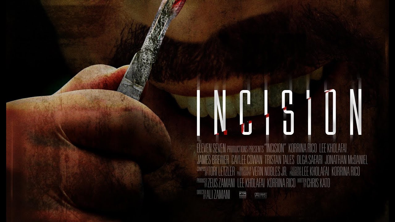 Watch Incision
